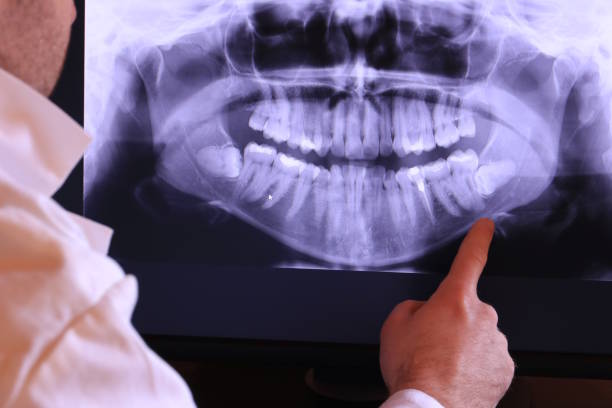 Best Emergency Tooth Extraction in Marsing, ID