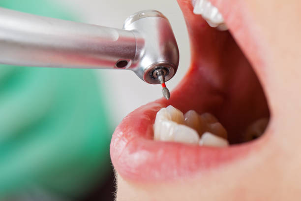 Best Emergency Gum Treatment in Marsing, ID